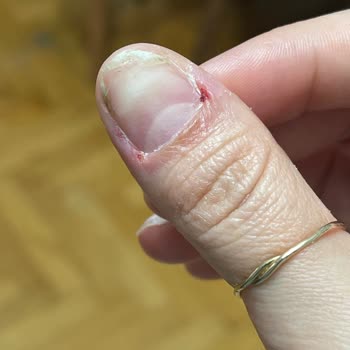 Gratis Beauty Ümraniye Santral Jel Tırnak Yapmayı Bilmiyor