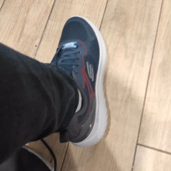 Maltepe Piazza Skechers Ayakkabı Ayak Bileğini Yaraladı
