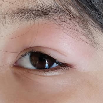 Richmond Ephesus Resort Haşere Sinek Hizmet