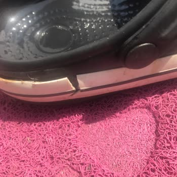 Akınal Bella Terlik Şeridi Deforme Olması