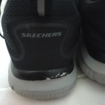 Skechers Erkek Ayakkabı Deformasyonu!