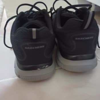 Skechers Erkek Ayakkabı Deformasyonu!