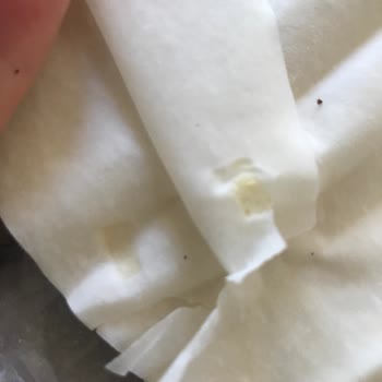 Nimet Gıda Üründen Yabancı Cisim Çıkması