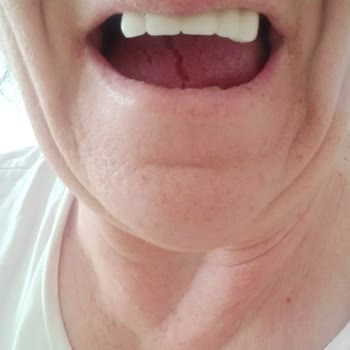 Vera Hastanesi Diş Taktırma Hayal Kırıklığı