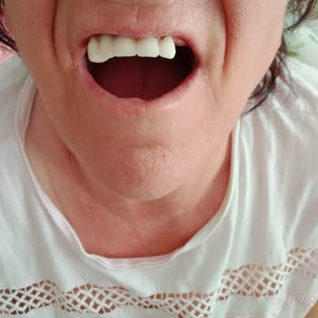 Vera Hastanesi Diş Taktırma Hayal Kırıklığı