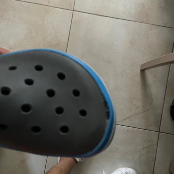 The Dark Side of Crocs Slippers: Beware of Sun Damage!