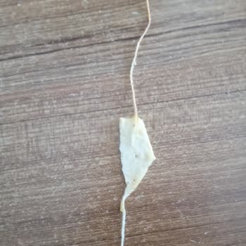 Ülker Çizi Atıştırmalık Paketinden İp Çıktı