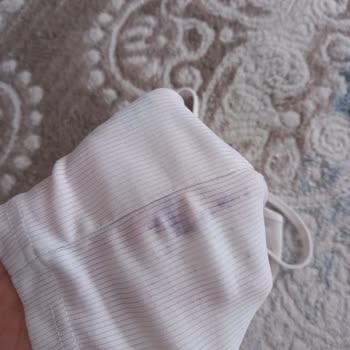 Kamil Koç Şahsi Eşyalarıma Verilen Zarar