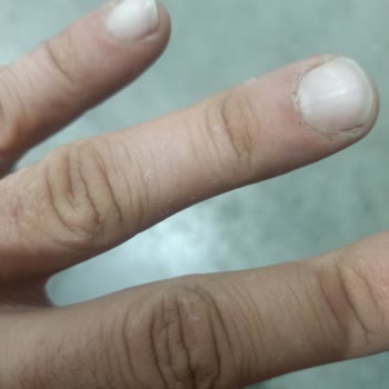 Dalan Sıvı Sabun Elle Verdiği Hasar