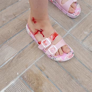 Sandıklı Termal Otel Güvenlik Eksikliği