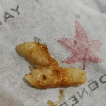 Yaprak Dönercisi Yaprak Dönerci Kalite Yoksunluğu; Pişmemiş Çiğ Döner Verilmesi