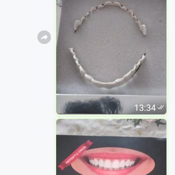 Dental Diş Protezi Sahte Diş Kalıbı