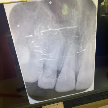 İzmir Menderes Özel Ağız Diş Sağlık Merkezi'nden Şikayetçiyim