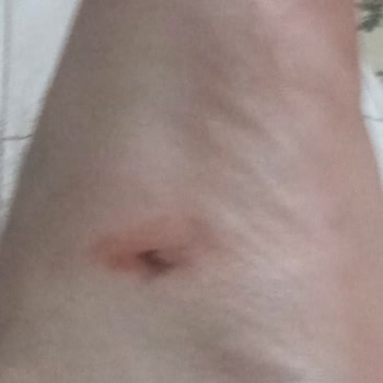 Raid Sinekkovar Likit İşe Yaramıyor