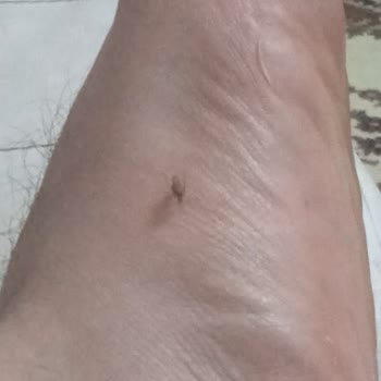 Raid Sinekkovar Likit İşe Yaramıyor