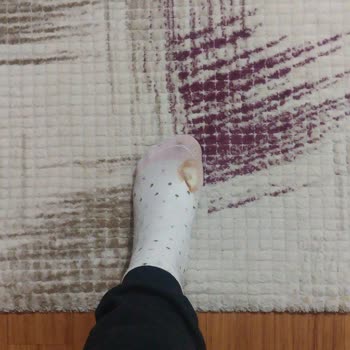FLO Ayakkabı Sert Bot Ayağı Yara Yaptı Fotoğrafla Belgeledik Sorun Çözülmedi.