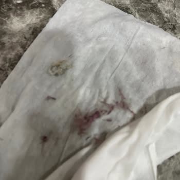 Electrolux Çamaşır Makinesi Servis Şikayeti