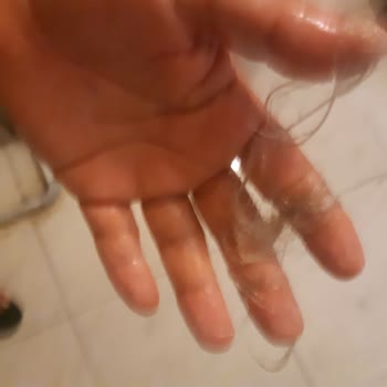 Mixup Şampuan Saç Dökmesi