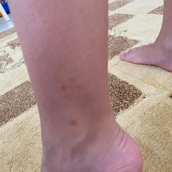 Raid Sinek Kovucu İşe Yaramıyor