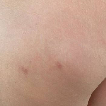 Raid Sinek Kovucu İşe Yaramıyor