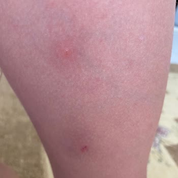 Raid Sinek Kovucu İşe Yaramıyor