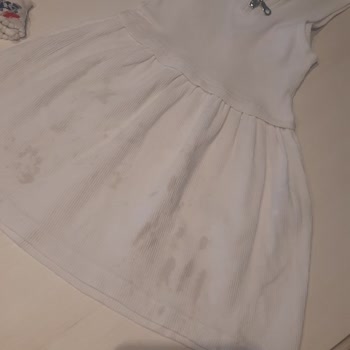 Vanish Oxi Leke Çıkarıcı Elbiseyi Leke İçinde Bıraktı