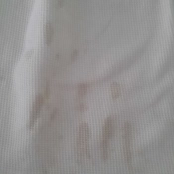 Vanish Oxi Leke Çıkarıcı Elbiseyi Leke İçinde Bıraktı