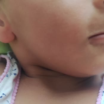 Mustela Stick Güneş Koruyucu Leke Yaptı!