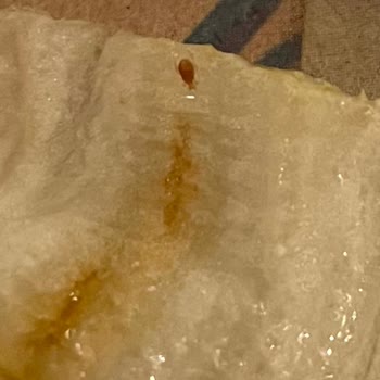 City's Nişantaşı Bizim Lokantada Salatada Böcek Çıktı