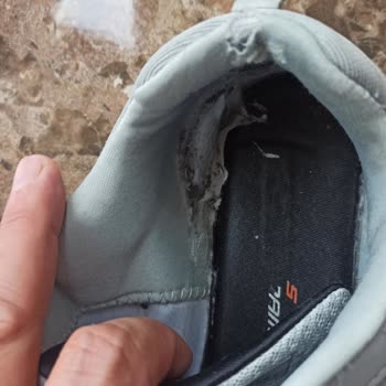 Skechers Ayakkabı Garanti Ve Müşteri Memnuniyetini Sorunu