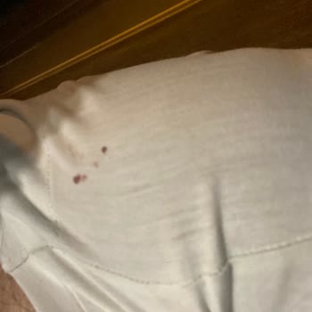 Süha Turizm Aracında Böcekler Var