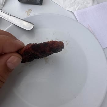 Köfteci Yusuf Yemekten Çıkan Kıl!