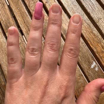 Vanner Estetik Protez Tırnak Deneyimim