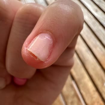 Vanner Estetik Protez Tırnak Deneyimim