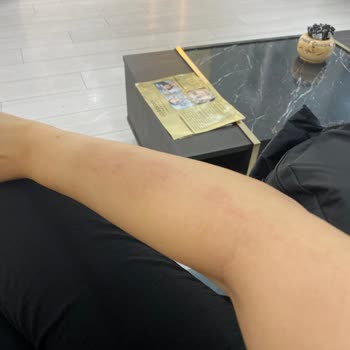 Golden GÜZELLİK (golden Plazadaki) Kollarım Yandı!