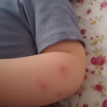 Raid Elektrolikit 45 Gece Sineklerden Korumuyor!