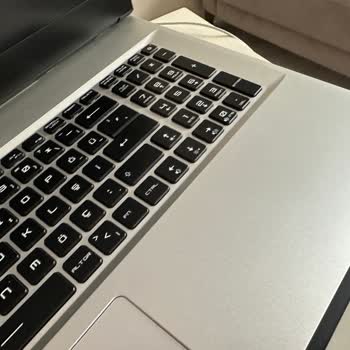 Monster Notebook Tulpar T7 V25.1 Monitör Şişmesi (1 Yılı Dolmadan)