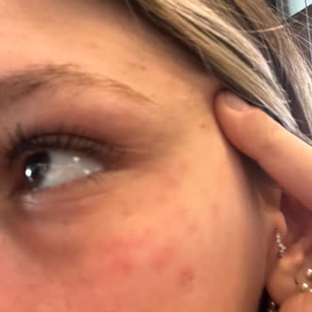 Rise & Shine Maderise Memnun Değilim