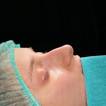 Op. Dr. Uğur Harputluoğlu Hiç Memnun Değilim