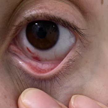 Gülay Aydoğan Beauty Memnuniyetsizliği