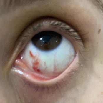 Gülay Aydoğan Beauty Memnuniyetsizliği