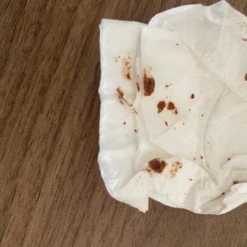 Şölen Çikolatanın İçinden Ne Olduğu Belli Olmayan Parça Çıktı