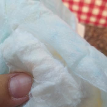 Prima Bebek Bezinde Sert Parçalar Var.