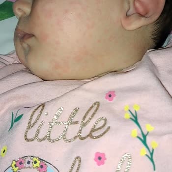 Bebelac Toz Mama Sorunu