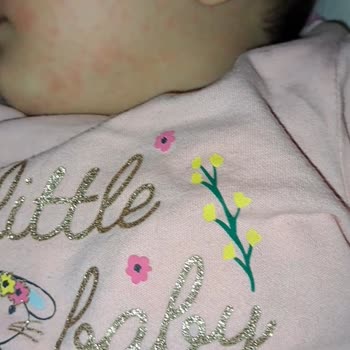 Bebelac Toz Mama Sorunu