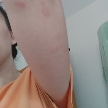 Mersin Nur Turizm Otobüsünde Tahta Kurusu İle Mücadele Edememek