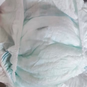 Molfix Bebek Bezinin İçinden Yabancı Madde Çıktı
