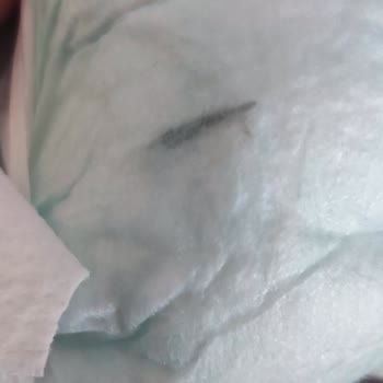 Molfix Bebek Bezinin İçinden Yabancı Madde Çıktı