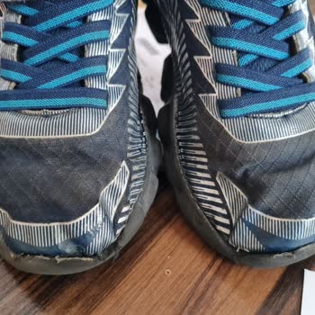 Skechers Çocuk Ayakkabısı Üretim Hatasının Marka Tarafından İnkarı