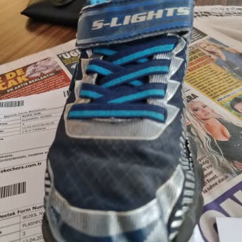 Skechers Çocuk Ayakkabısı Üretim Hatasının Marka Tarafından İnkarı